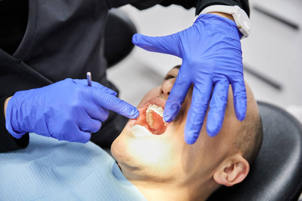 Best Knocked-Out Tooth (Avulsed Tooth) Treatment in Oregon, IL